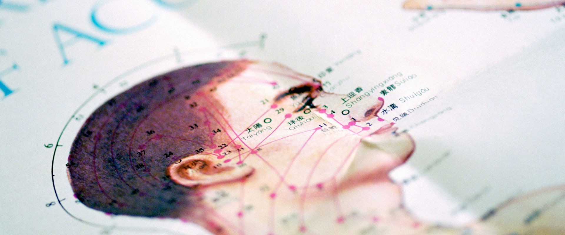 Complementary medicine Picture of acupuncture points on the head.